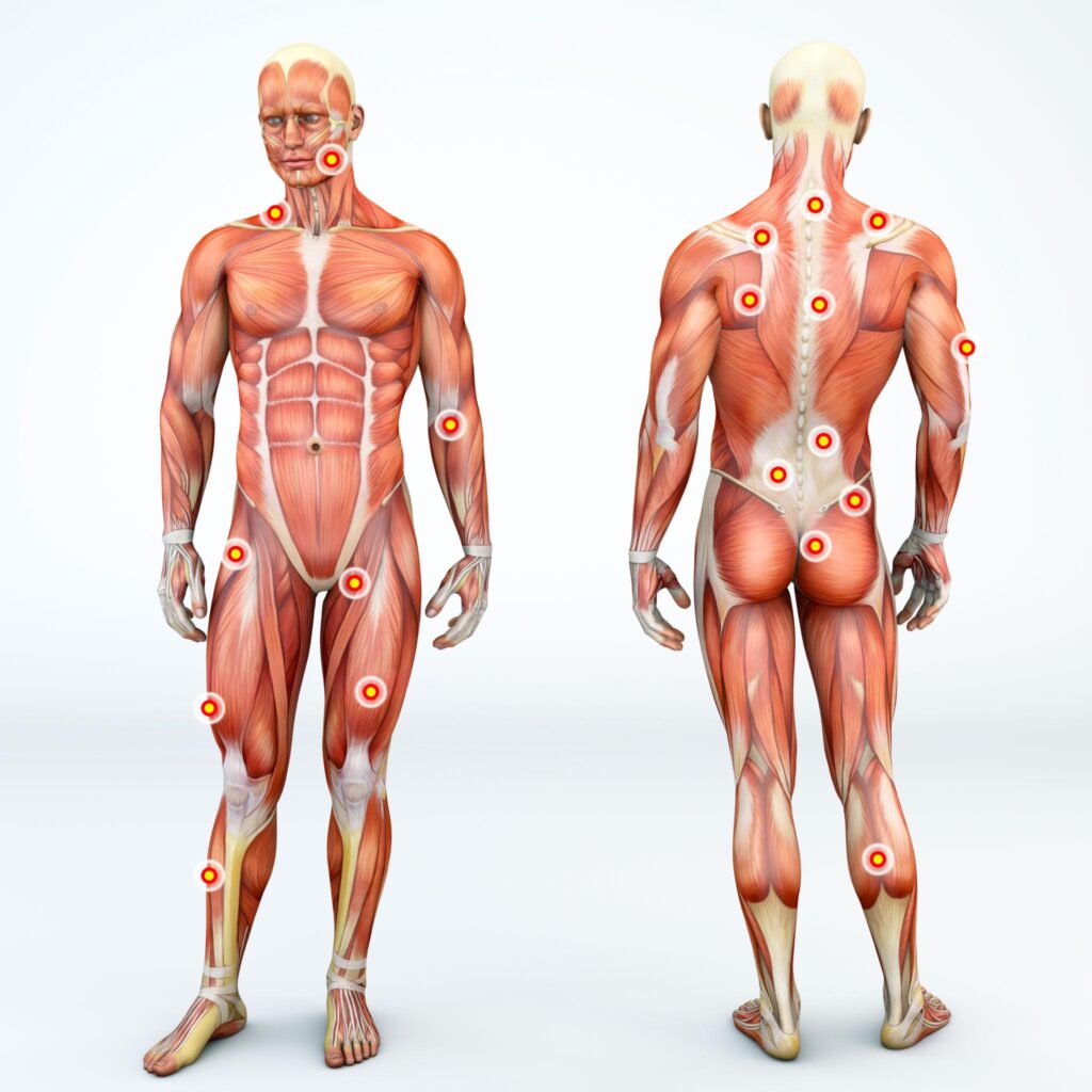 what steroid is used for trigger point injections​