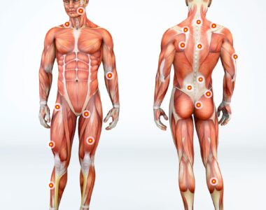 what steroid is used for trigger point injections​